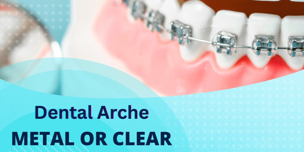 Discovering the Best Dentist in Vasant Kunj: A Guide to Dental Excellence at Dental Arche ?